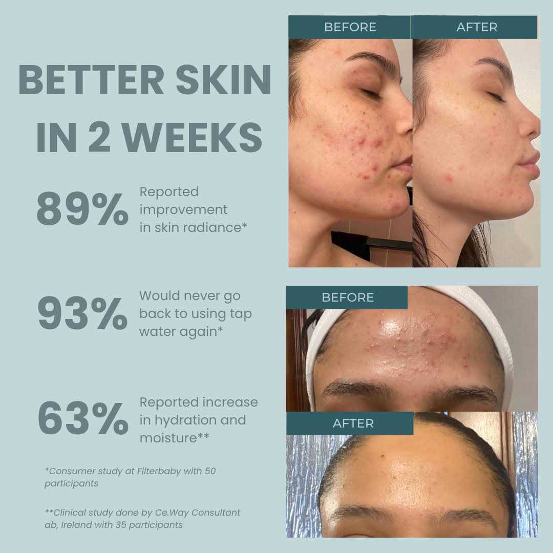 Filterbaby Advanced Water Filter With PRODermis - Image 3